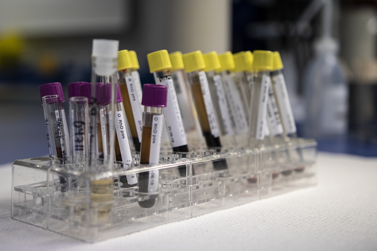 Insulin injections and ways to minimize pain